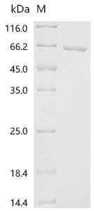 Pseudomonas aeruginosa B-type flagellin (fliC) Recombinant Protein, Pseudomonas aeruginosa (strain ATCC 15692 / PAO1 / 1C / PRS 101 / LMG 12228), E.coli, N-terminal 6xHis-SUMO-tagged, 62.2 kDa, purity >≥ 95% as determined by SDS-PAGE.