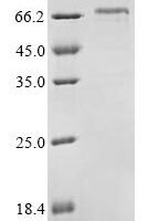 Mouse Neurofilament light polypeptide (Nefl) Recombinant Protein, N-His - BioCrest Sci