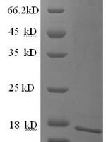 Human Cell adhesion molecule CEACAM4 (CEACAM4), partial Recombinant Protein - BioCrest Sci