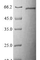 Mouse Serine/threonine-protein kinase STK11 (Stk11) Recombinant Protein - BioCrest Sci