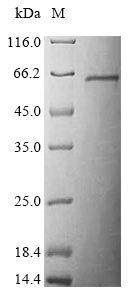Mouse Serine/threonine-protein kinase STK11 (Stk11) Recombinant Protein, Mus musculus (Mouse), Baculovirus, N-terminal 10xHis-tagged and C-terminal Myc-tagged, 52.9 kDa, purity >≥ 85% as determined by SDS-PAGE.
