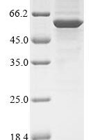 Human Serine/threonine-protein phosphatase 2A 55 kDa regulatory subunit B gamma isoform (PPP2R2C) Recombinant Protein, N-10His/C-Myc, aa 1–447, Baculovirus - BioCrest Sci