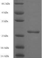 Simian immunodeficiency virus Protein Vpx (vpx) Recombinant Protein - BioCrest Sci