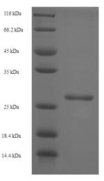 Simian immunodeficiency virus Protein Vpx (vpx) Recombinant Protein, Simian immunodeficiency virus (isolate PBj14/BCL-3) (SIV-sm) (Simian immunodeficiency virus sooty mangabey monkey), E.coli, N-terminal 6xHis-SUMO-tagged, 28.9 kDa, purity >≥ 90% as determined by SDS-PAGE.