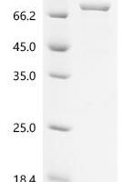 Xenopus laevis Cyclin-A2 (ccna2) Recombinant Protein - BioCrest Sci