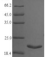 Salmonella typhi Universal stress protein A (uspA) Recombinant Protein, N-His, aa 2–144, E.coli - BioCrest Sci