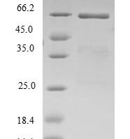 Human Translation initiation factor eIF-2B subunit beta (EIF2B2) Recombinant Protein - BioCrest Sci
