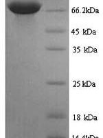 Rat Pyruvate kinase PKLR (Pklr) Recombinant Protein - BioCrest Sci