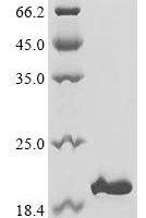Cat Leukocyte associated immunoglobulin like receptor 1 (LAIR1), partial Recombinant Protein - BioCrest Sci