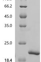 Simian retrovirus SRV-2 Gag polyprotein (gag), partial Recombinant Protein, C-His, aa 2–100, E.coli - BioCrest Sci