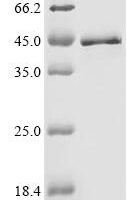 Human Serine/arginine-rich splicing factor 1 (SRSF1) (S199A,S227A,S234A,S238A) Recombinant Protein - BioCrest Sci