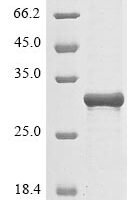 Human Protein mono-ADP-ribosyltransferase PARP14 (PARP14), partial Recombinant Protein, N-10His/C-Myc, aa 1605–1801, E.coli - BioCrest Sci