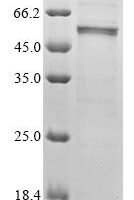 Mouse Cis-aconitate decarboxylase (Acod1) Recombinant Protein, N-10His/C-Myc - BioCrest Sci