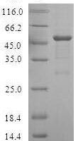 Human Ubiquitin-like-conjugating enzyme ATG10 (ATG10) Recombinant Protein - BioCrest Sci