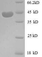 Human Insulin-like growth factor II protein (PP1446), partial Recombinant Protein - BioCrest Sci