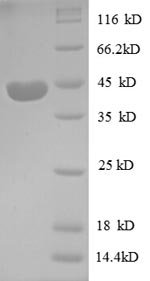 Human Insulin-like growth factor II protein (PP1446), partial Recombinant Protein, Homo sapiens (Human), E.coli, N-terminal GST-tagged, 44.1 kDa, purity >≥ 90% as determined by SDS-PAGE.