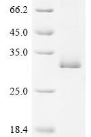 Human herpesvirus 6A Envelope glycoprotein H (gH), partial Recombinant Protein - BioCrest Sci