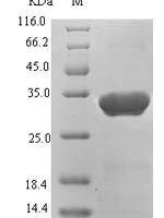 Hepatitis B virus genotype D subtype ayw Protein X (X) Recombinant Protein, N-His-SUMO, aa 1–154, UniProt P03165 - BioCrest Sci