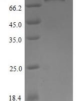 Human Tyrosine-protein kinase receptor UFO (AXL) (D266N), partial Recombinant Protein, C-hFc1 - BioCrest Sci