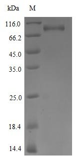 Human Tyrosine-protein kinase receptor UFO (AXL) (D266N), partial Recombinant Protein, C-hFc1, Homo sapiens (Human), Mammalian cell, C-terminal hFc1-tagged, 75.1 kDa, purity >≥ 85% as determined by SDS-PAGE.