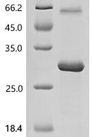 Human Apolipoprotein M(APOM) Recombinant Protein - BioCrest Sci