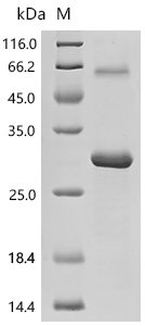 Human Apolipoprotein M(APOM) Recombinant Protein, Homo sapiens (Human), E.coli, C-terminal 6xHis-tagged, 26.1 kDa, purity >≥ 90% as determined by SDS-PAGE.