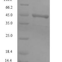 BK polyomavirus Major capsid protein VP1 Recombinant Protein, N-10His/C-Myc - BioCrest Sci