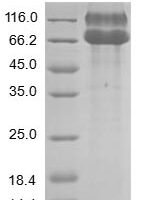 Human Ephrin type-A receptor 2 (EPHA2), partial Recombinant Protein - BioCrest Sci