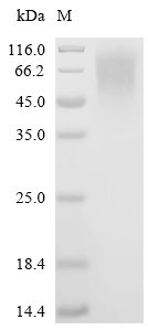 Mouse Lysosome-associated membrane glycoprotein 1 (Lamp1), partial Recombinant Protein, C-His, Mus musculus (Mouse), Mammalian cell, C-terminal 6xHis-tagged, 39.9 kDa, purity >≥95% as determined by SDS-PAGE.