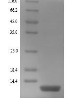 Human Beta-defensin 130 (DEFB130) Recombinant Protein - BioCrest Sci