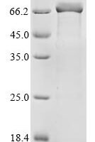 Human parainfluenza 4b virus Nucleoprotein (N) Recombinant Protein - BioCrest Sci