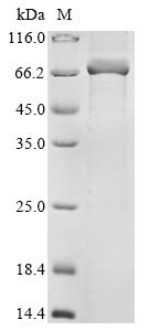 Human parainfluenza 4b virus Nucleoprotein (N) Recombinant Protein, Human parainfluenza 4b virus (strain 68-333) (HPIV-4b), E.coli, N-terminal 10xHis-tagged, 68.5 kDa, purity >≥ 85% as determined by SDS-PAGE.