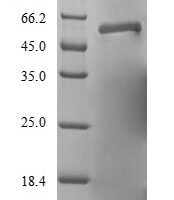 Human respiratory syncytial virus A Fusion glycoprotein F0 (F), partial Recombinant Protein, N-10His/C-Myc - BioCrest Sci