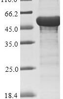 Human adenovirus F serotype 41 Hexon protein (L3), partial Recombinant Protein - BioCrest Sci