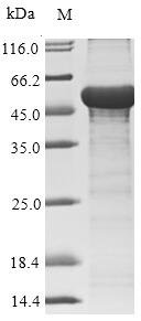 Human adenovirus F serotype 41 Hexon protein (L3), partial Recombinant Protein, Human adenovirus F serotype 41 (HAdV-41) (Human adenovirus 41), E.coli, N-terminal 10xHis-SUMO-tagged and C-terminal Myc-tagged, 52.4 kDa, purity >≥ 85% as determined by SDS-PAGE.
