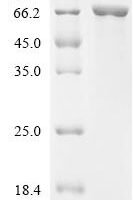 Xanthomonas albilineans Peptidoglycan D,D-transpeptidase FtsI (ftsI), partial Recombinant Protein - BioCrest Sci
