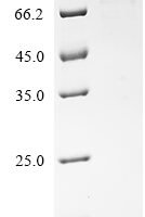 Human Major centromere autoantigen B (CENPB) Recombinant Protein - BioCrest Sci