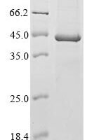 Murine polyomavirus Major capsid protein VP1 Recombinant Protein, N-His - BioCrest Sci