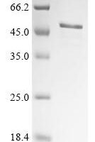 Human herpesvirus 1 E3 ubiquitin-protein ligase ICP0 (ICP0), partial Recombinant Protein - BioCrest Sci