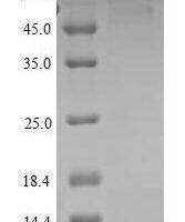 Rat Semaphorin-3A (Sema3a) Recombinant Protein - BioCrest Sci