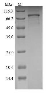Rat Semaphorin-3A (Sema3a) Recombinant Protein, Rattus norvegicus (Rat), E.coli, N-terminal 6xHis-tagged, 90.6 kDa, purity >≥ 90% as determined by SDS-PAGE.