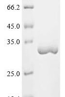Saponaria officinalis Ribosome-inactivating protein saporin-9 (SAP9) Recombinant Protein - BioCrest Sci