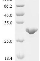 Escherichia coli Inorganic pyrophosphatase (ppa) Recombinant Protein - BioCrest Sci