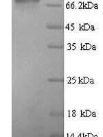 Human Glucokinase regulatory protein (GCKR) Recombinant Protein, N-His - BioCrest Sci