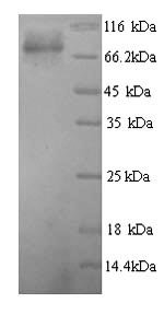 Human Glucokinase regulatory protein (GCKR) Recombinant Protein, N-His, Homo sapiens (Human), Yeast, N-terminal 6xHis-tagged, 70.7 kDa, purity >≥ 90% as determined by SDS-PAGE.