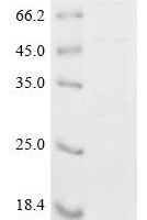 Staphylococcus aureus Immunoglobulin-binding protein sbi (sbi) Recombinant Protein, N-MBP/C-His - BioCrest Sci