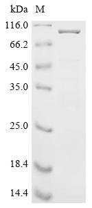 Staphylococcus aureus Immunoglobulin-binding protein sbi (sbi) Recombinant Protein, N-MBP/C-His, Staphylococcus aureus (strain NCTC 8325 / PS 47), E.coli, N-terminal MBP-tagged and C-terminal 6xHis-tagged, 90.8 kDa, purity >≥ 85% as determined by SDS-PAGE.