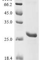 Human Sterol O-acyltransferase 1 (SOAT1), partial Recombinant Protein - BioCrest Sci