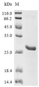 Human Sterol O-acyltransferase 1 (SOAT1), partial Recombinant Protein, E.coli, C-terminal 6xHis-tagged, 22.5 kDa, purity >≥ 85% as determined by SDS-PAGE.