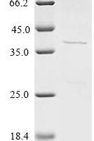 Mumps virus Fusion glycoprotein F0 (F), partial Recombinant Protein - BioCrest Sci